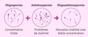 Produit Naturel pour L'Asthénospermie