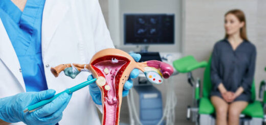 Comment Traiter Naturellement un Fibrome Sous-Muqueux ?